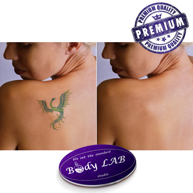 product Премахване на татуировки и перманентен грим с лазер image carousel