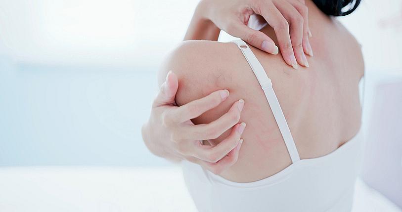 С екзема съм &ndash; не трябва да се къпя&hellip; main image