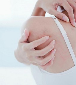 article С екзема съм &ndash; не трябва да се къпя&hellip; thumbnail