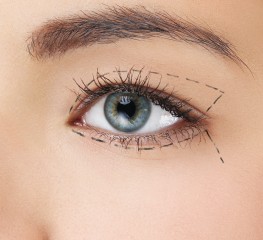 offer Блефаропластика на долен клепач thumbnail